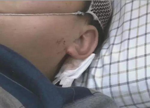 �����һ�𱻴����߀��������߅�����ϵ��ܴ������(j��ng)�^�t(y��)�������Д����ܴ�����~��Ƥ��ܛ�M�����[Û��һֱ���ڻ��Ԡ�B(t��i)��Ŀǰ߀�]�ж��^Σ�U�ڡ�